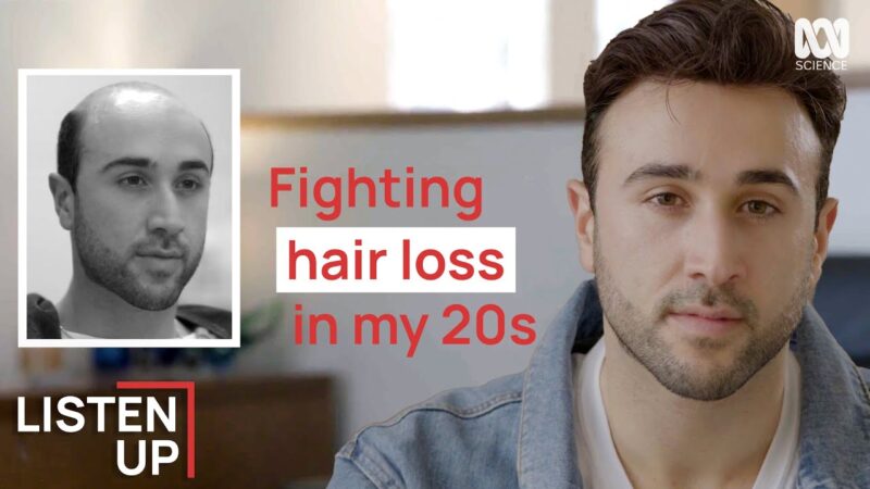 “I Started Losing My Hair At 20” | Listen Up | ABC Science