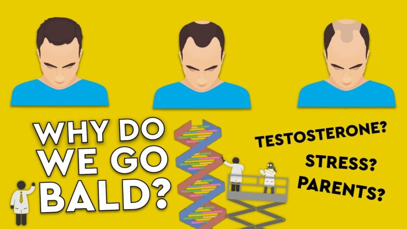 Why Do We Go Bald? / What Causes Hair Loss? #MYTHS #DEBUNKED