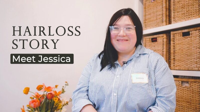 ♥Jessica found toppers for her hair loss. Now it’s just a part of her normal life. | Hair loss story