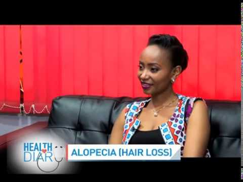 Alopecia: Hair loss causes and remedies || Health Diary