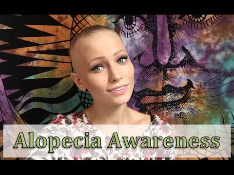 Misconceptions About Alopecia | Alopecia Awareness Month