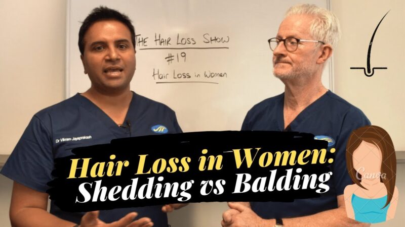 Hair Loss in Women  – Shedding vs Balding