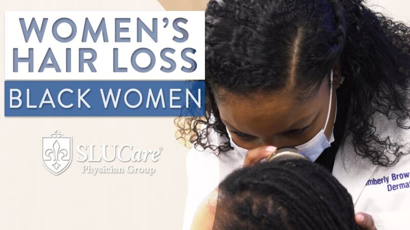 Examining Hair Loss in Black Women – SLUCare Dermatology