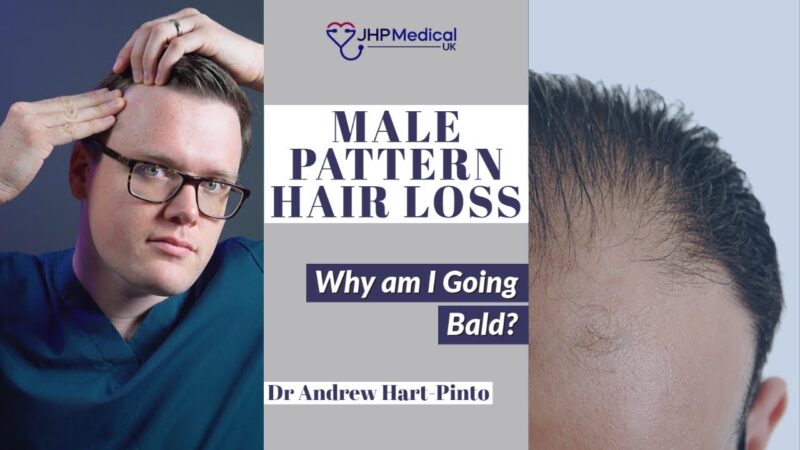 Why am I Going Bald? | Treatments for Male Pattern Hair Loss