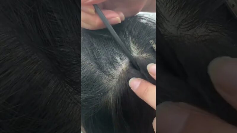 ✨Bald Spot Covered Using Invisible Cover-up Hair Patches | UniWigs