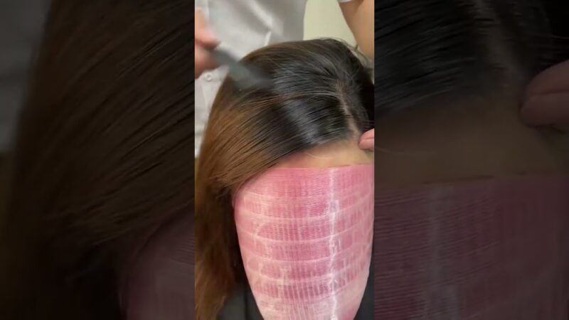 Strangely Satisfying: Woman’s Bald Spot Gets a Quick Fix! #hairpatch