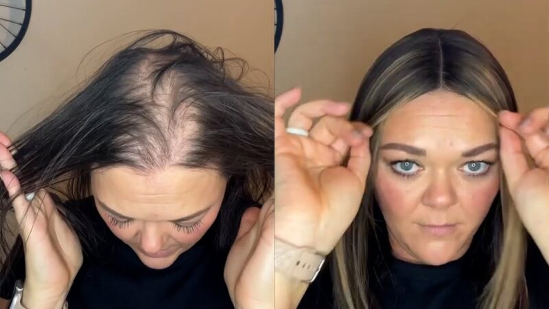 Hair Loss Does Not Mean U Can’t Be Beautiful |Hair Topper with Money Piece