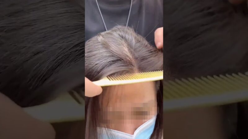 Can Receding Hairline Be Solved? YES! UniWigs Hairline Patch