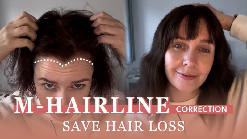 Solve Your M-Hairline Immediately | Receding Hairline | UniWigs Upgrade Courtney Hair Topper