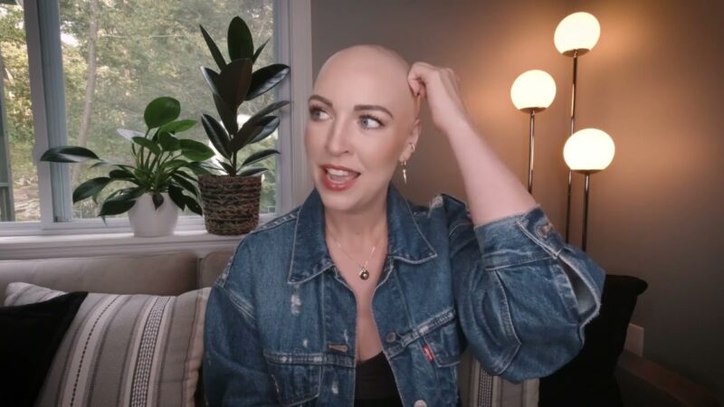 Embracing Alopecia: Liane’s Journey to Confidence and Strength!