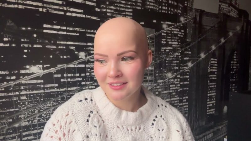 Marcy’s Alopecia Journey: Overcoming Challenges and Embracing Self-Acceptance