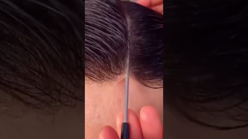 Can You Tell It is Fake Scalp? Solve Receding Hairline Immediately | UniWigs Hairline