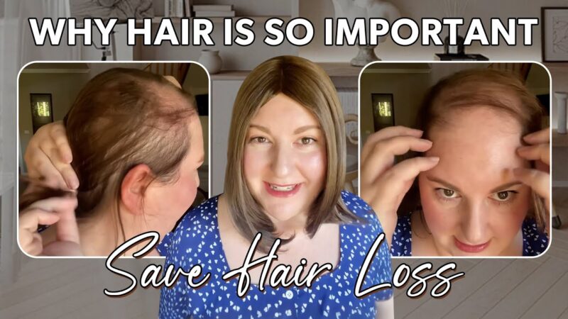 Why Hairstyle is So Important to Your Beauty | UniWigs Top Light Hair Topper Solves Hair Loss